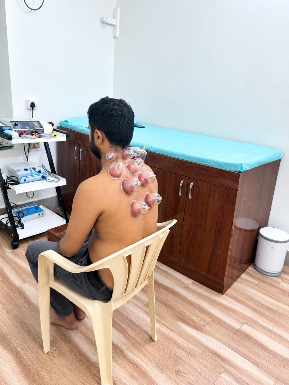 Patient receiving cupping therapy on the shoulders